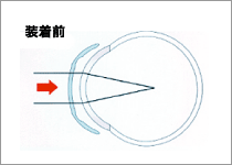 装着前