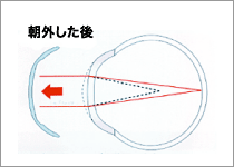 朝外した後