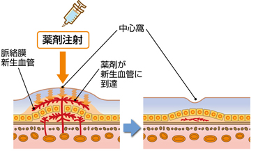 治療・・・